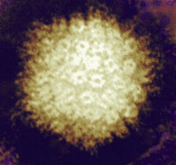 Varicella zoster virus